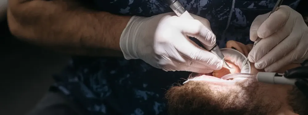 Cirugía Bucal y Maxilofacial en Planident, Lince