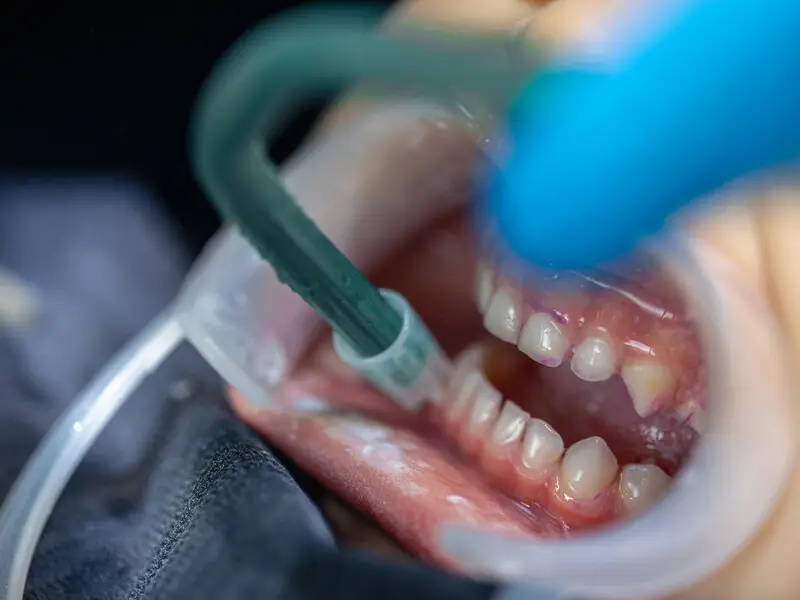 Detalle de Periodoncia en Planident