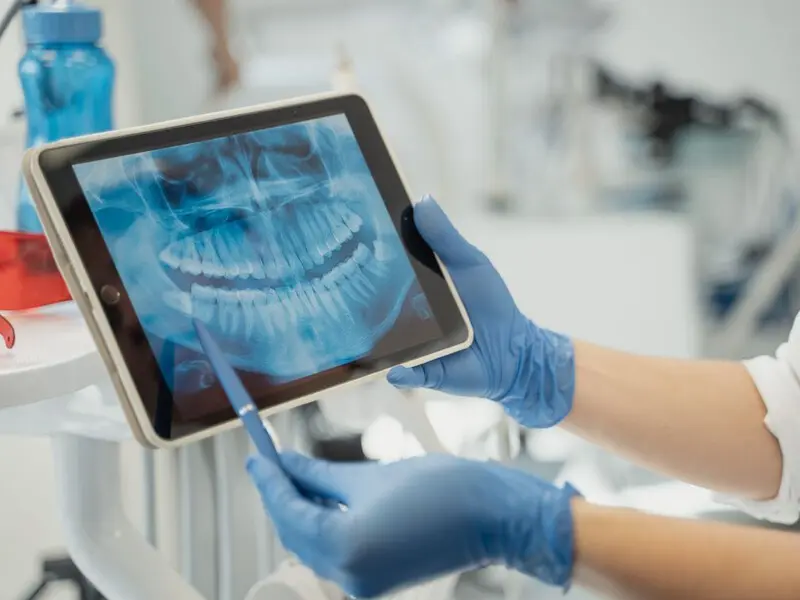 Detalle de Radiología en Planident
